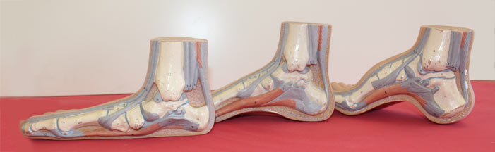 Frequently asked questions - Orthotics
